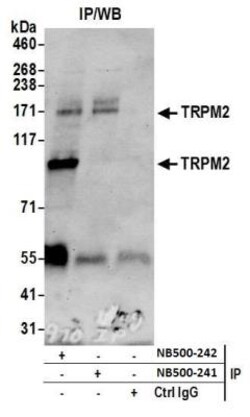 TRPM2 Antibody, Novus Biologicals 100 &mu;L | Buy Online | Novus Biologicals | Fisher Scientific