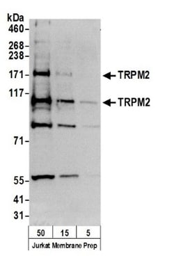 TRPM2 Antibody, Novus Biologicals 100 &mu;L | Buy Online | Novus Biologicals | Fisher Scientific