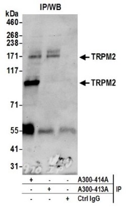 TRPM2 Antibody, Novus Biologicals 100 &mu;L | Buy Online | Novus Biologicals | Fisher Scientific