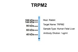 TRPM2 Antibody, Novus Biologicals 0.05mg; Unlabeled:Antibodies, Polyclonal
