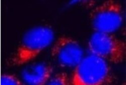 TRPM7 Antibody - Azide and BSA Free, Novus Biologicals:Antibodies:Primary
