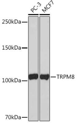 TRPM8 Rabbit anti-Human, Clone: 9S8N1, Novus Biologicals 20 &mu;g; Unconjugated:Antibodies,