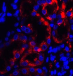 TRPV4 Antibody - BSA Free, Novus Biologicals 0.1mg; Unlabeled:Antibodies,