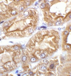 TRPV4 Antibody - BSA Free, Novus Biologicals 0.1mg; Unlabeled:Antibodies,