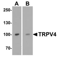 TRPV4 Antibody - BSA Free, Novus Biologicals 0.1mg; Unlabeled:Antibodies,