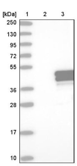 TRUB1 Antibody, Novus Biologicals 25ul | Buy Online | Novus Biologicals | Fisher Scientific
