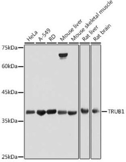 TRUB1 Rabbit anti-Human, Mouse, Rat, Polyclonal, Novus Biologicals 20 &mu;g | Buy Online | Novus Biologicals | Fisher Scientific