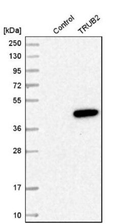 TRUB2 Antibody, Novus Biologicals 25 &mu;L; Unlabeled:Antibodies, Polyclonal