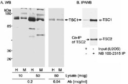 TSC1 Antibody, Novus Biologicals 100 &mu;L | Buy Online | Novus Biologicals | Fisher Scientific