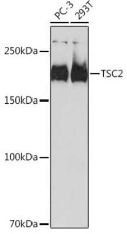TSC2 Rabbit anti-Human, Clone: 7X2C6, Novus Biologicals 20 &mu;g; Unconjugated:Antibodies,