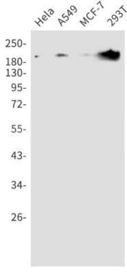 TSC2 Rabbit anti-Human, Clone: S06-0D3, Novus Biologicals 25 &mu;g | Buy Online | Bio-Techne | Fisher Scientific