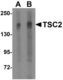 TSC2 Antibody - BSA Free, Novus Biologicals 0.025 mg, Unconjugated:Antibodies,