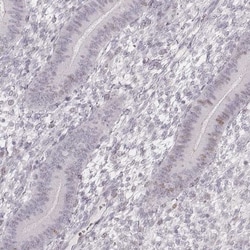 TSC21 Antibody, Novus Biologicals:Antibodies:Primary Antibodies