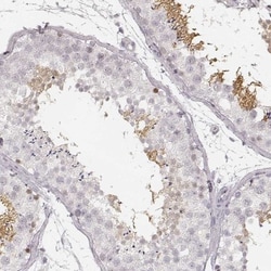 TSC21 Antibody, Novus Biologicals:Antibodies:Primary Antibodies