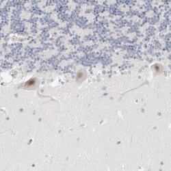 TSEN2 Antibody, Novus Biologicals 25 &mu;L; Unlabeled:Antibodies, Polyclonal