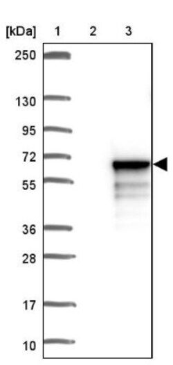 TSEN2 Antibody, Novus Biologicals 25 &mu;L; Unlabeled:Antibodies, Polyclonal