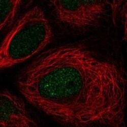 TSEN54 Rabbit anti-Human, Polyclonal, Novus Biologicals:Antibodies:Primary