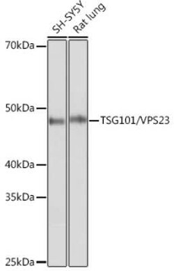 TSG101 Rabbit anti-Human, Rat, Clone: 4T4W6, Novus Biologicals:Antibodies:Primary