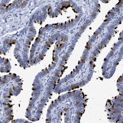 TSGA2 Antibody, Novus Biologicals 0.1mL; Unlabeled:Antibodies, Polyclonal