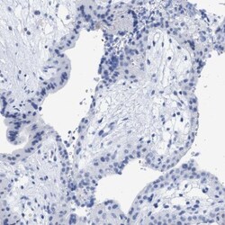 TSGA2 Antibody, Novus Biologicals 25 &mu;L; Unlabeled:Antibodies, Polyclonal