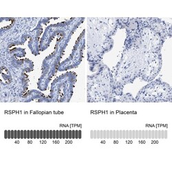 TSGA2 Antibody, Novus Biologicals 25 &mu;L; Unlabeled:Antibodies, Polyclonal