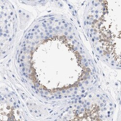 TSGA2 Antibody, Novus Biologicals 25 &mu;L; Unlabeled:Antibodies, Polyclonal