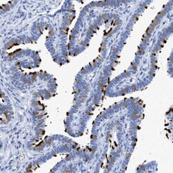 TSGA2 Antibody, Novus Biologicals 25 &mu;L; Unlabeled:Antibodies, Polyclonal