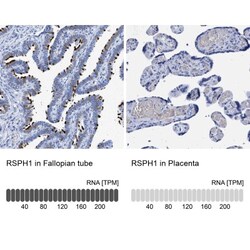 TSGA2 Antibody, Novus Biologicals 25 &mu;L; Unlabeled:Antibodies, Polyclonal