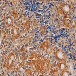 TSHR Antibody (4C1) - BSA Free, Novus Biologicals:Antibodies:Primary Antibodies