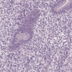TSKS Antibody, Novus Biologicals 0.1mL; Unlabeled:Antibodies, Polyclonal