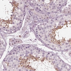TSKS Antibody, Novus Biologicals 0.1mL; Unlabeled:Antibodies, Polyclonal