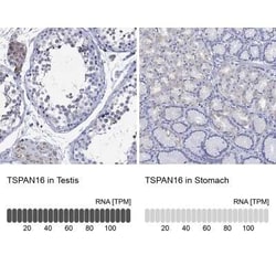 TSPAN16 Rabbit anti-Human, Polyclonal, Novus Biologicals:Antibodies:Primary