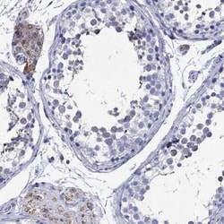 TSPAN16 Rabbit anti-Human, Polyclonal, Novus Biologicals:Antibodies:Primary