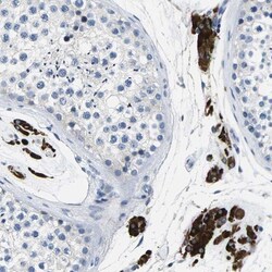 TSPAN2 Antibody, Novus Biologicals 0.1mL; Unlabeled:Antibodies, Polyclonal