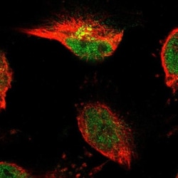 TSPAN3 Antibody, Novus Biologicals:Antibodies:Primary Antibodies