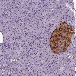 TSPAN7/TM4SF2 Antibody, Novus Biologicals 25 &mu;L; Unlabeled:Antibodies,