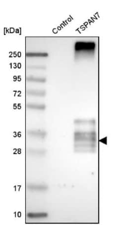TSPAN7/TM4SF2 Antibody, Novus Biologicals 25 &mu;L; Unlabeled:Antibodies,
