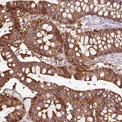 TSPAN8/TM4SF3 Antibody, Novus Biologicals:Antibodies:Primary Antibodies