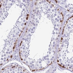 TSPY4 Antibody, Novus Biologicals 25 &mu;L; Unlabeled:Antibodies, Polyclonal