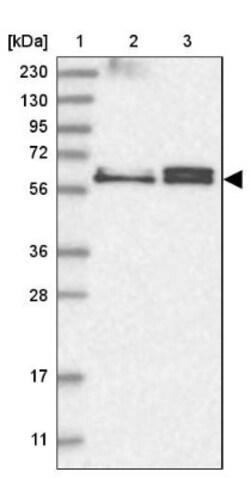 TSPYL1 Antibody, Novus Biologicals 0.1mL; Unlabeled:Antibodies, Polyclonal