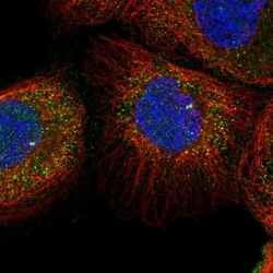 TSPYL6 Antibody, Novus Biologicals 0.1mL; Unlabeled:Antibodies, Polyclonal