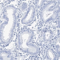 TSPYL6 Antibody, Novus Biologicals 0.1mL; Unlabeled:Antibodies, Polyclonal