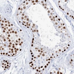 TSPYL6 Antibody, Novus Biologicals 0.1mL; Unlabeled:Antibodies, Polyclonal