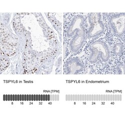 TSPYL6 Antibody, Novus Biologicals 25 &mu;L | Buy Online | Novus Biologicals | Fisher Scientific