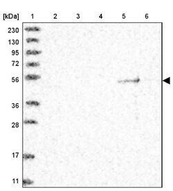 TSPYL6 Antibody, Novus Biologicals 25 &mu;L | Buy Online | Novus Biologicals | Fisher Scientific