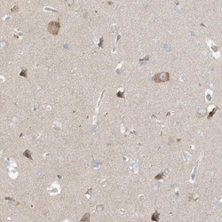 TSSC1 Antibody, Novus Biologicals:Antibodies:Primary Antibodies