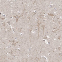TSSC1 Antibody, Novus Biologicals 0.1mL; Unlabeled:Antibodies, Polyclonal