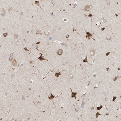 TSSC1 Antibody, Novus Biologicals 0.1mL; Unlabeled:Antibodies, Polyclonal