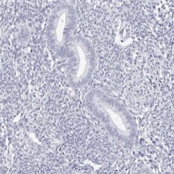 TSSK1 Antibody, Novus Biologicals 0.1mL; Unlabeled:Antibodies, Polyclonal