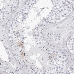 TSSK1 Antibody, Novus Biologicals 0.1mL; Unlabeled:Antibodies, Polyclonal